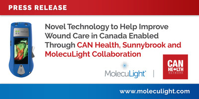 Novel Technology to Help Improve Wound Care in Canada Enabled Through CAN Health, Sunnybrook and MolecuLight Collaboration
